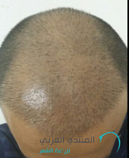 www.hairarab.com1469410056621.png