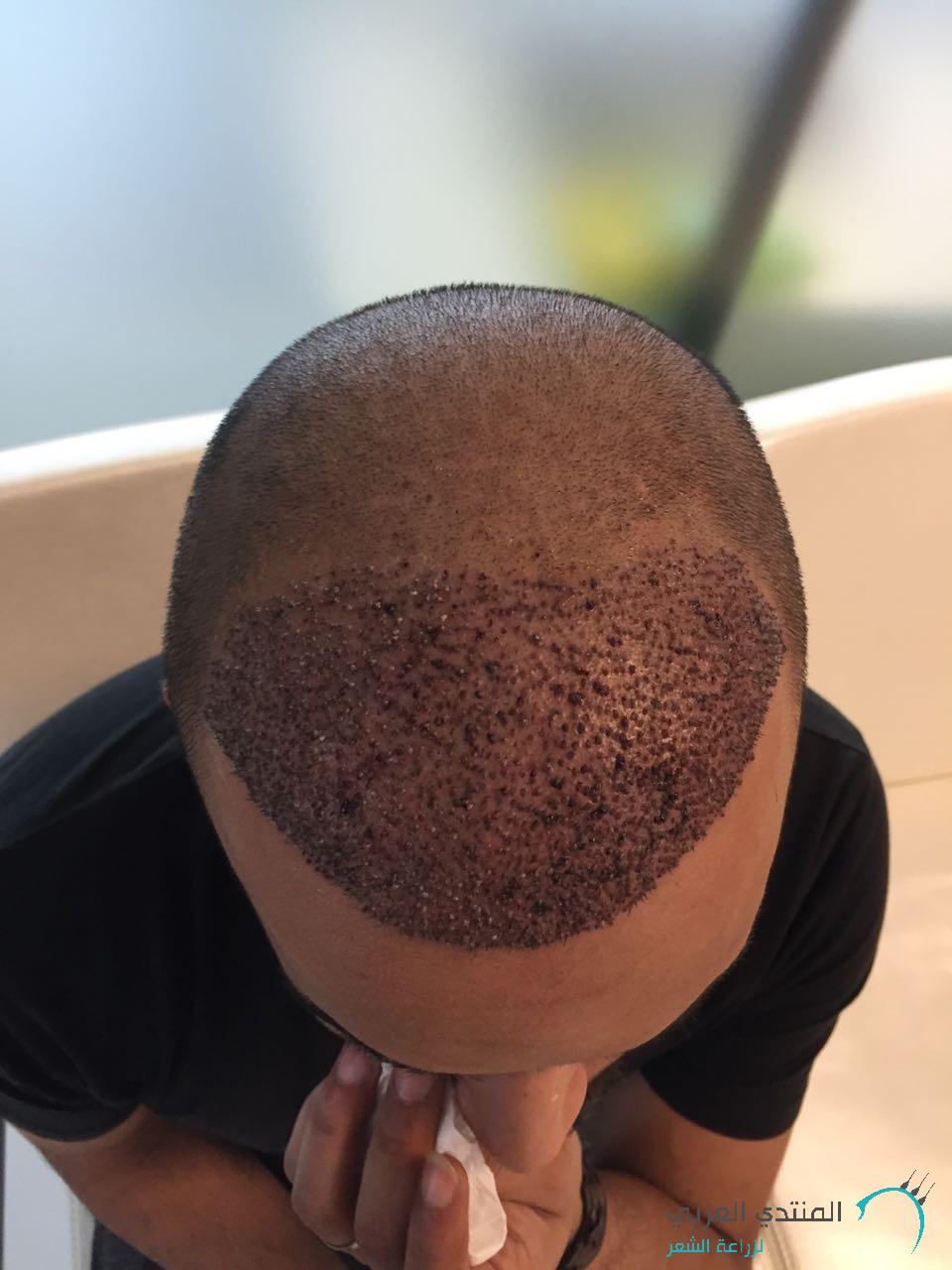 www.hairarab.com1486