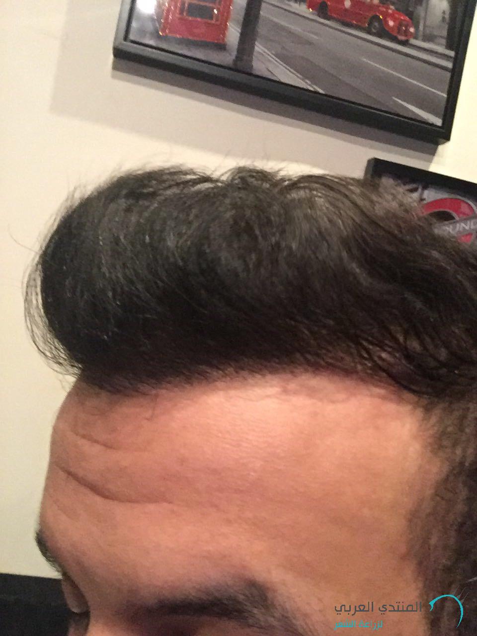 www.hairarab.com1486