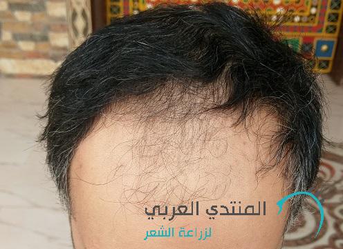 www.hairarab.com149241787597141.jpg