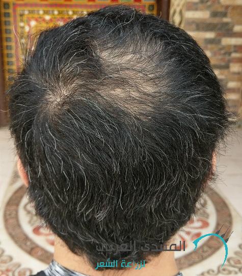 www.hairarab.com149241787604442.jpg