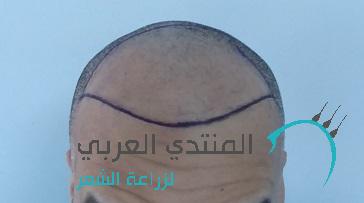 www.hairarab.com149241836057871.jpg