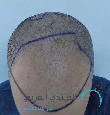 www.hairarab.com149241836065192.jpg