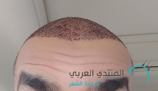 www.hairarab.com149241859483211.jpg