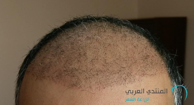 www.hairarab.com149440127127941.jpg