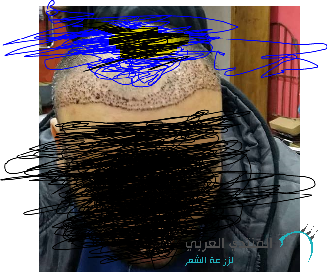 www.hairarab.com15162459153812.png