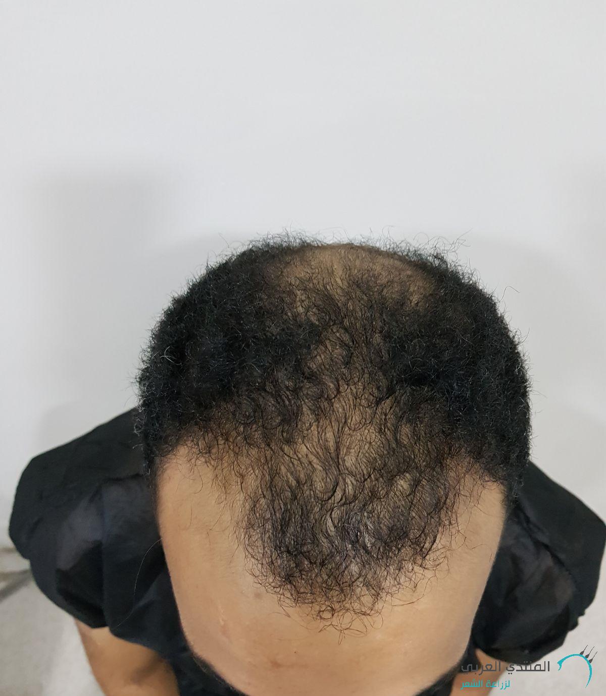 www.hairarab.com152323352813691.jpg