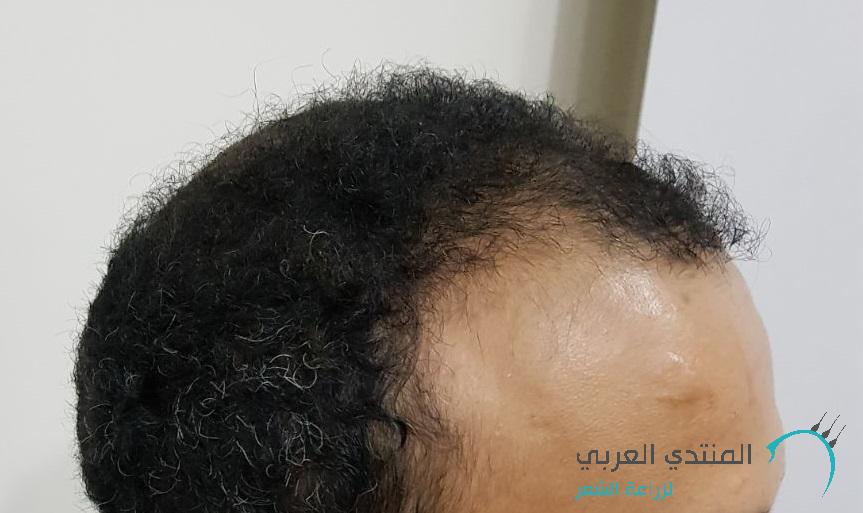 www.hairarab.com152660097938811.jpg