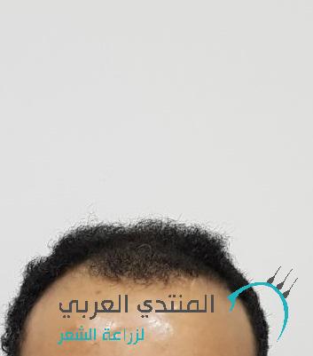 www.hairarab.com15266009794192.jpg