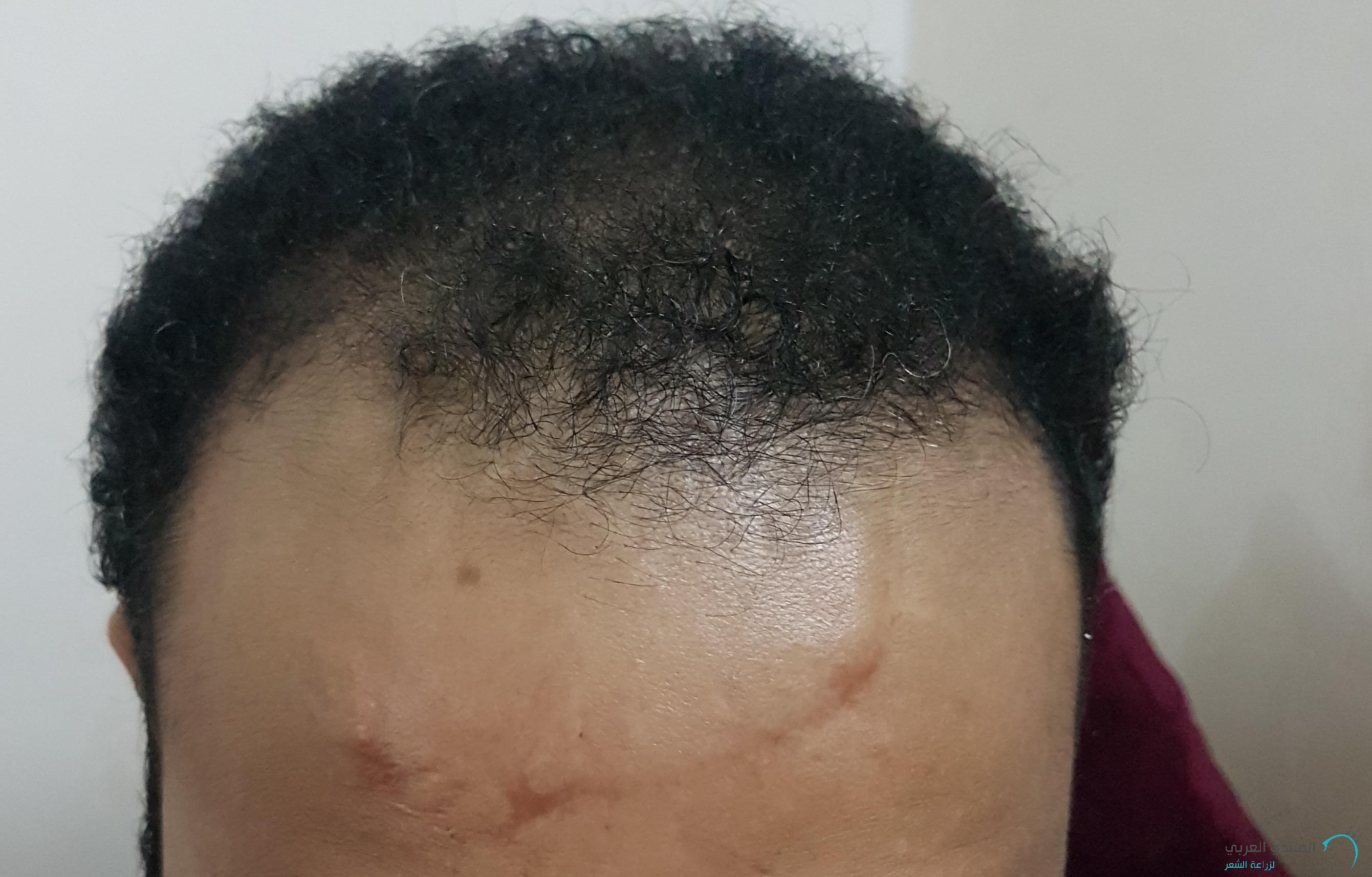 www.hairarab.com152660097943573.jpg