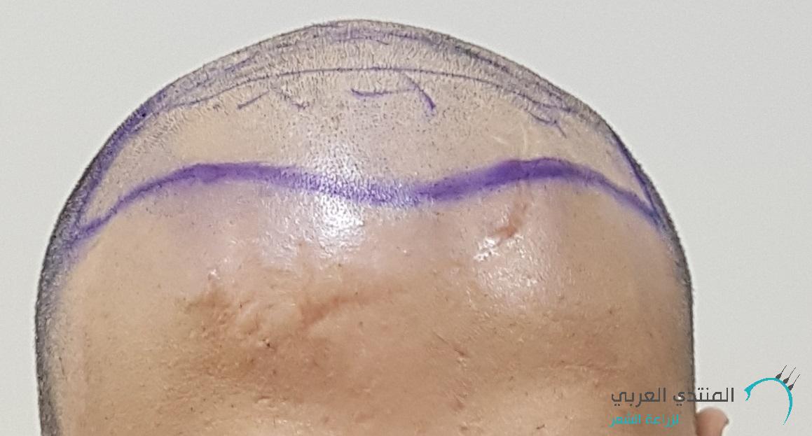 www.hairarab.com152660097968444.jpg
