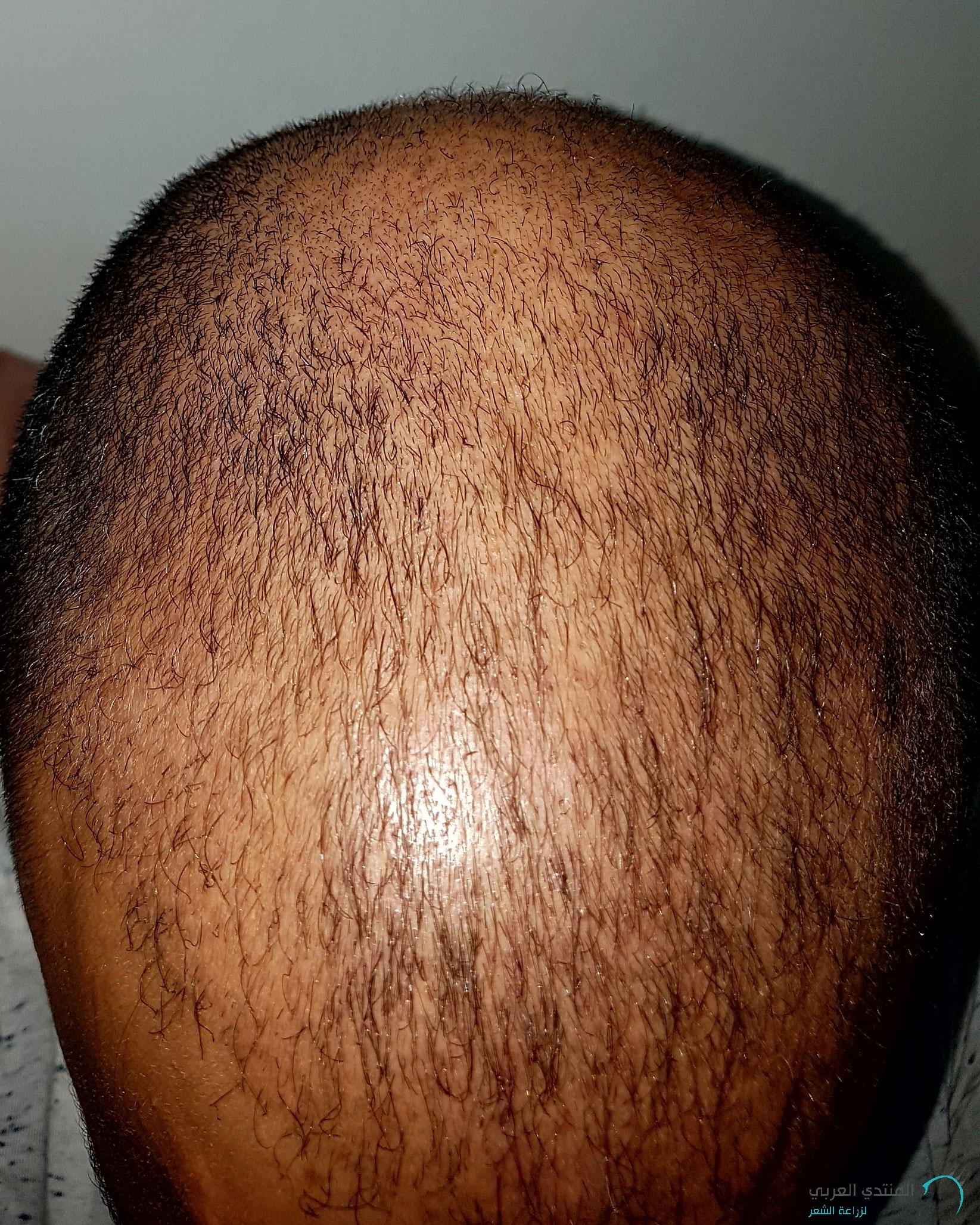 www.hairarab.com152660675075511.jpg
