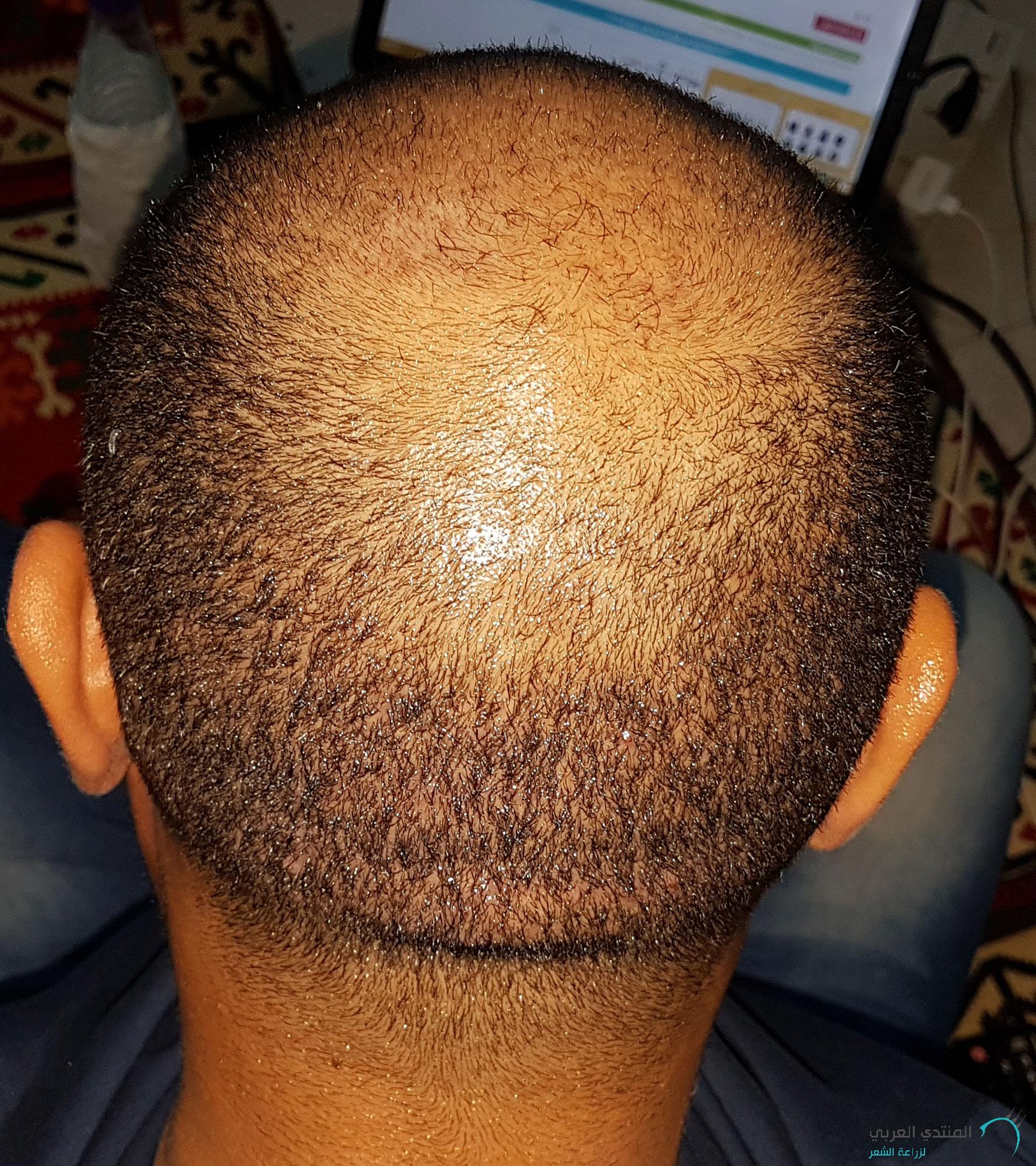 www.hairarab.com152660675095012.jpg