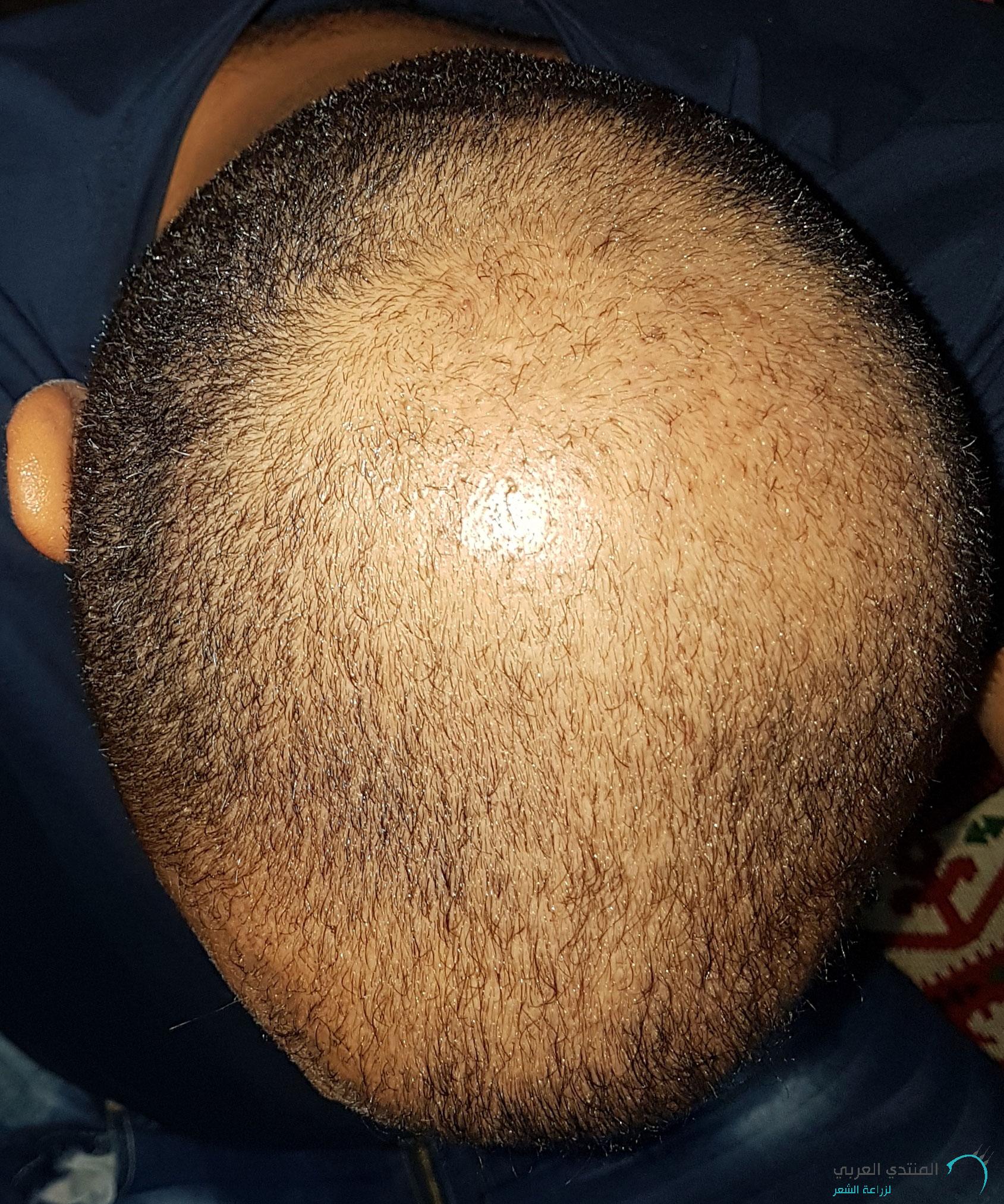 www.hairarab.com152660675208673.jpg