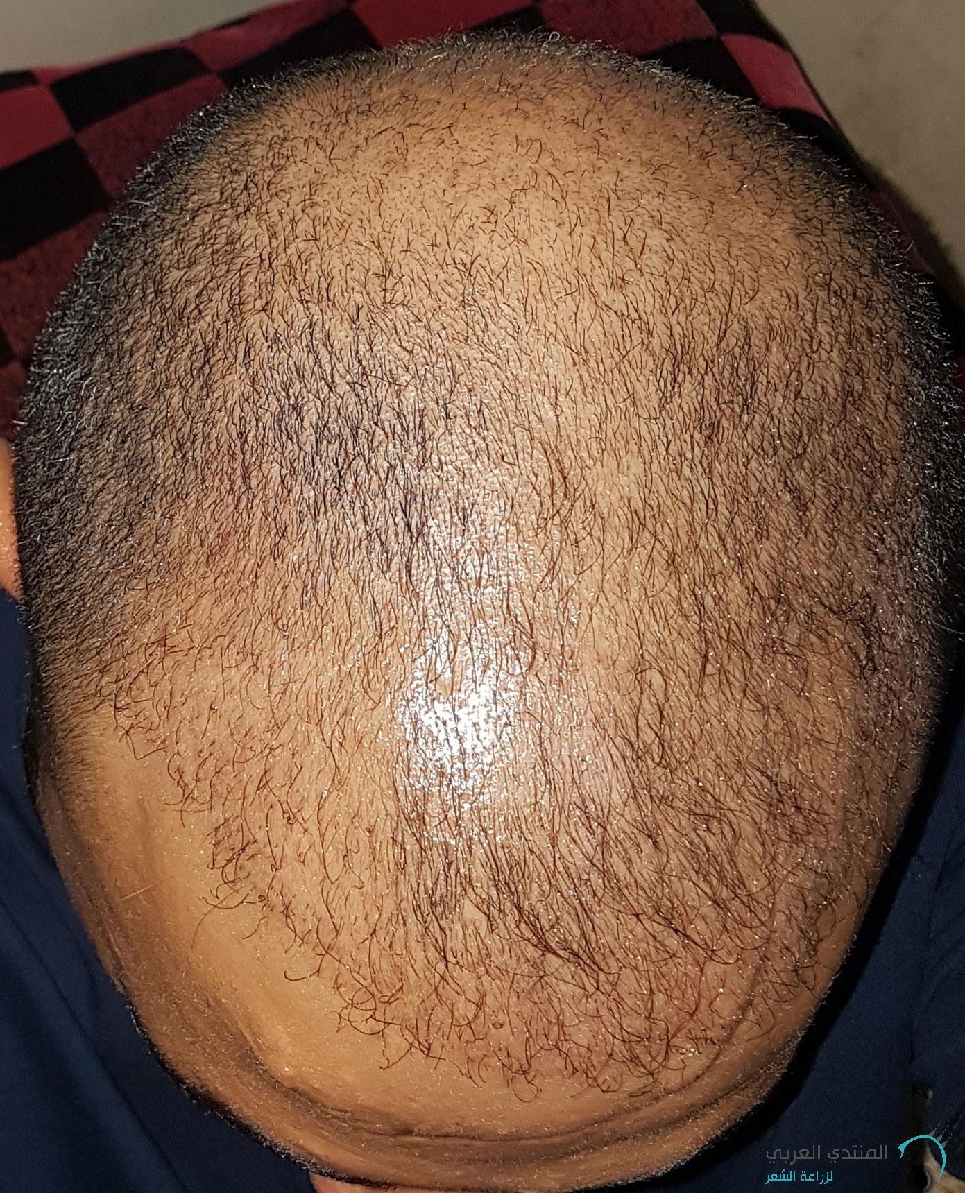 www.hairarab.com152660675755774.jpg