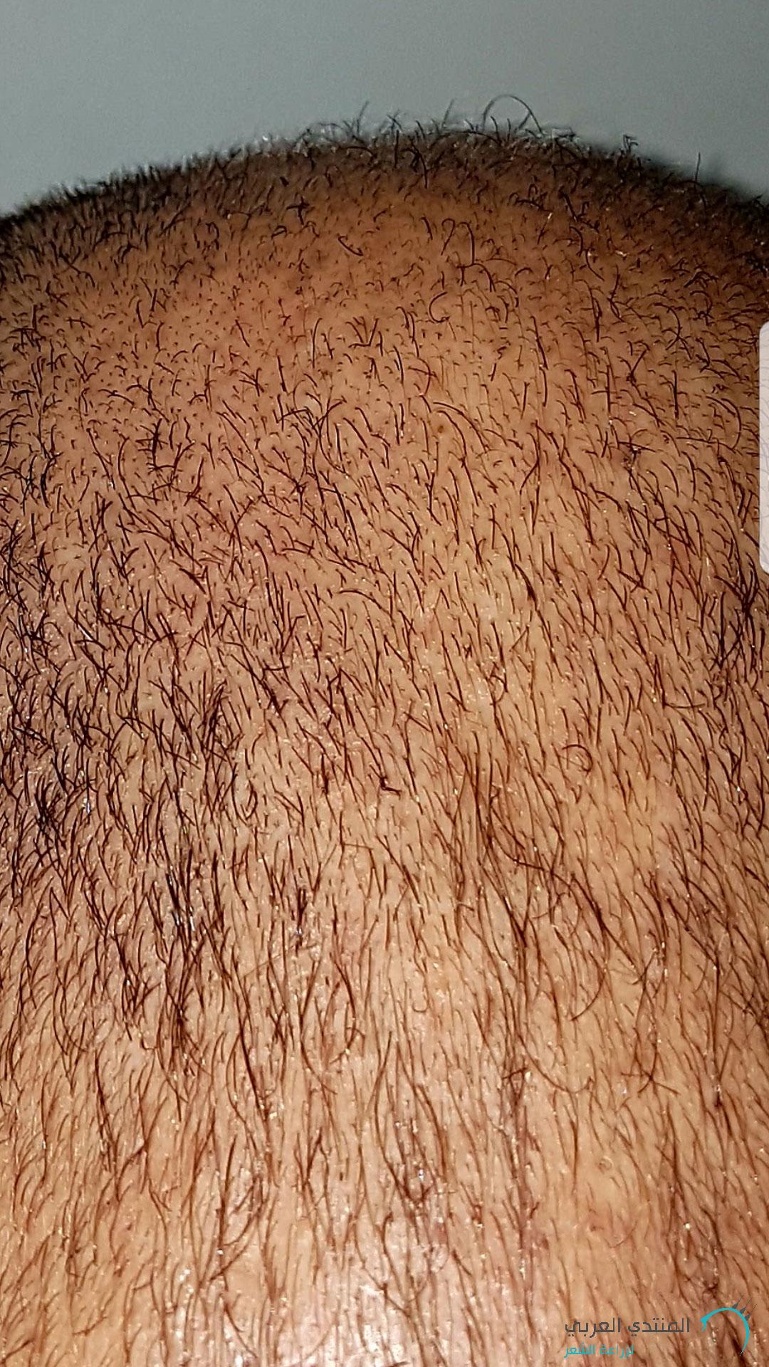 www.hairarab.com152660675775525.jpg