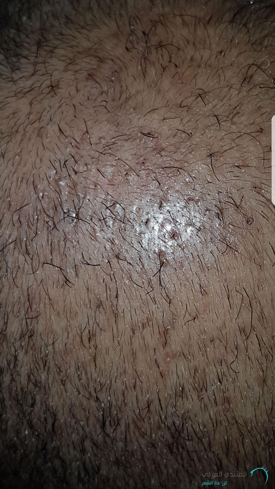 www.hairarab.com152660675909837.jpg