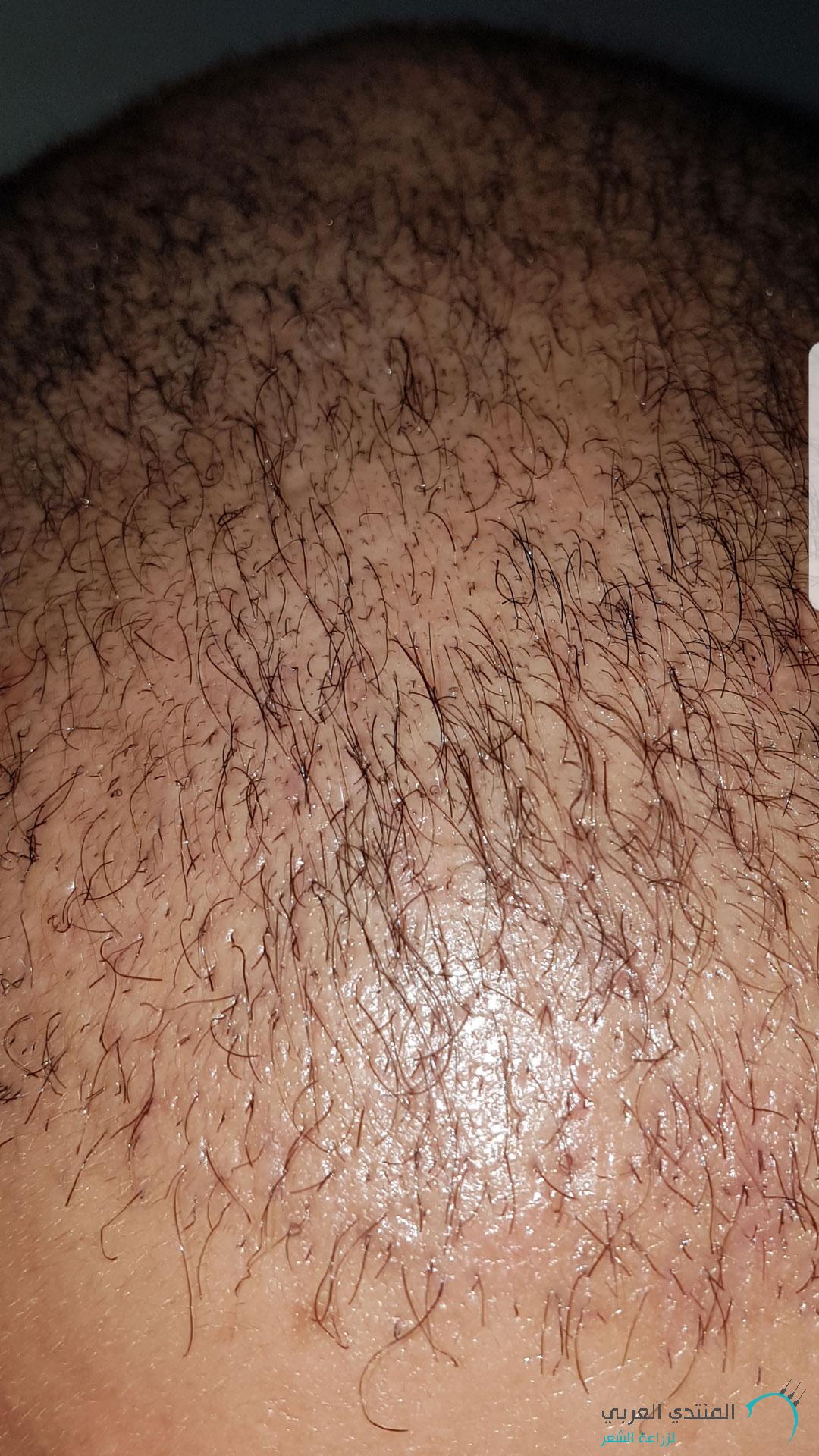 www.hairarab.com152660675923498.jpg