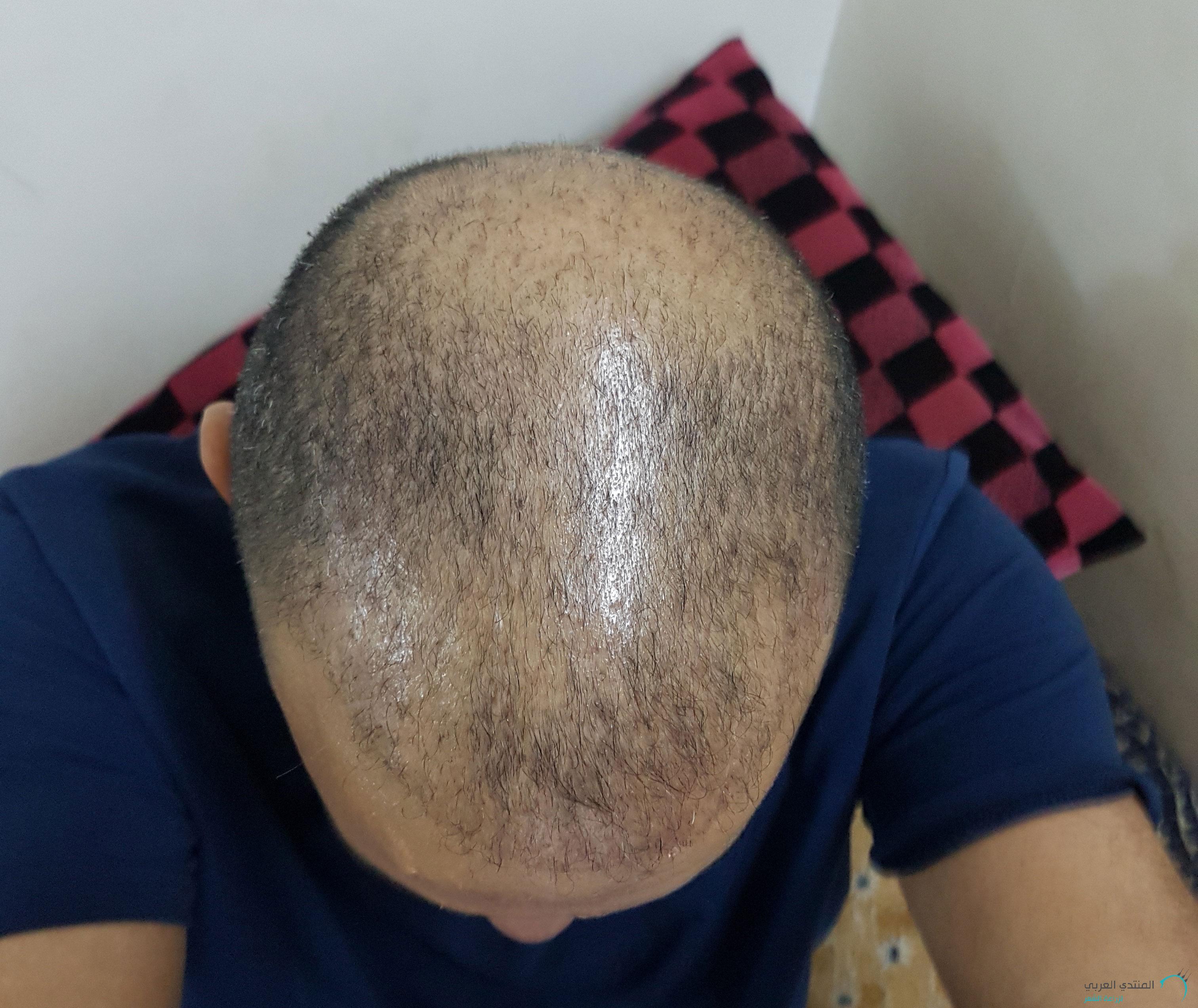 www.hairarab.com152660821285231.jpg