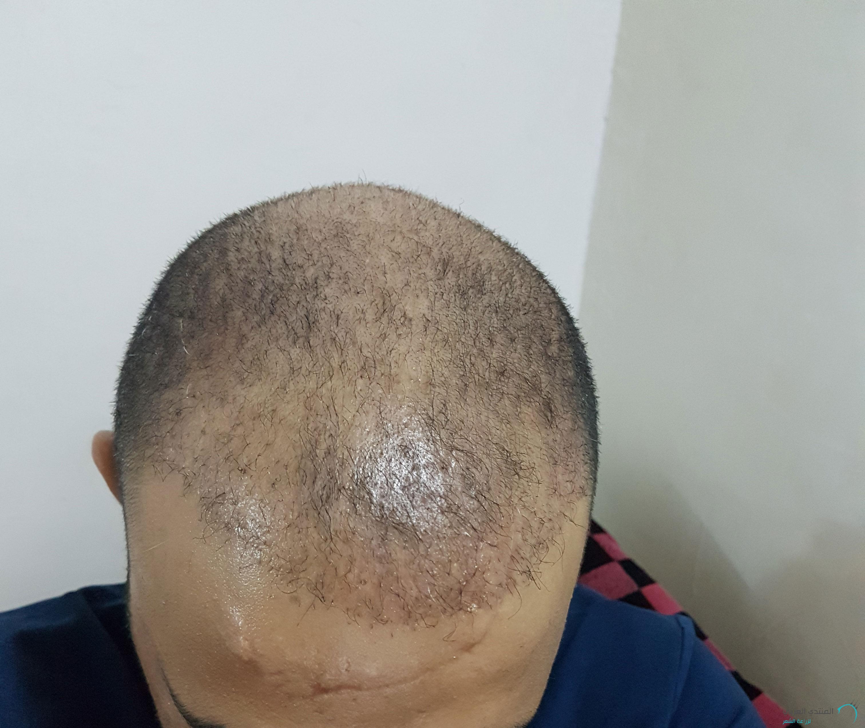 www.hairarab.com152660821335222.jpg