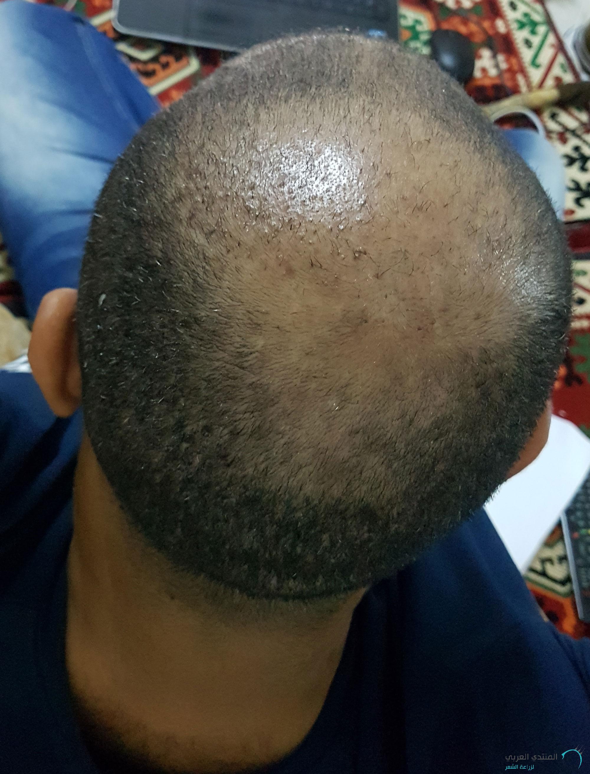 www.hairarab.com152660821373313.jpg