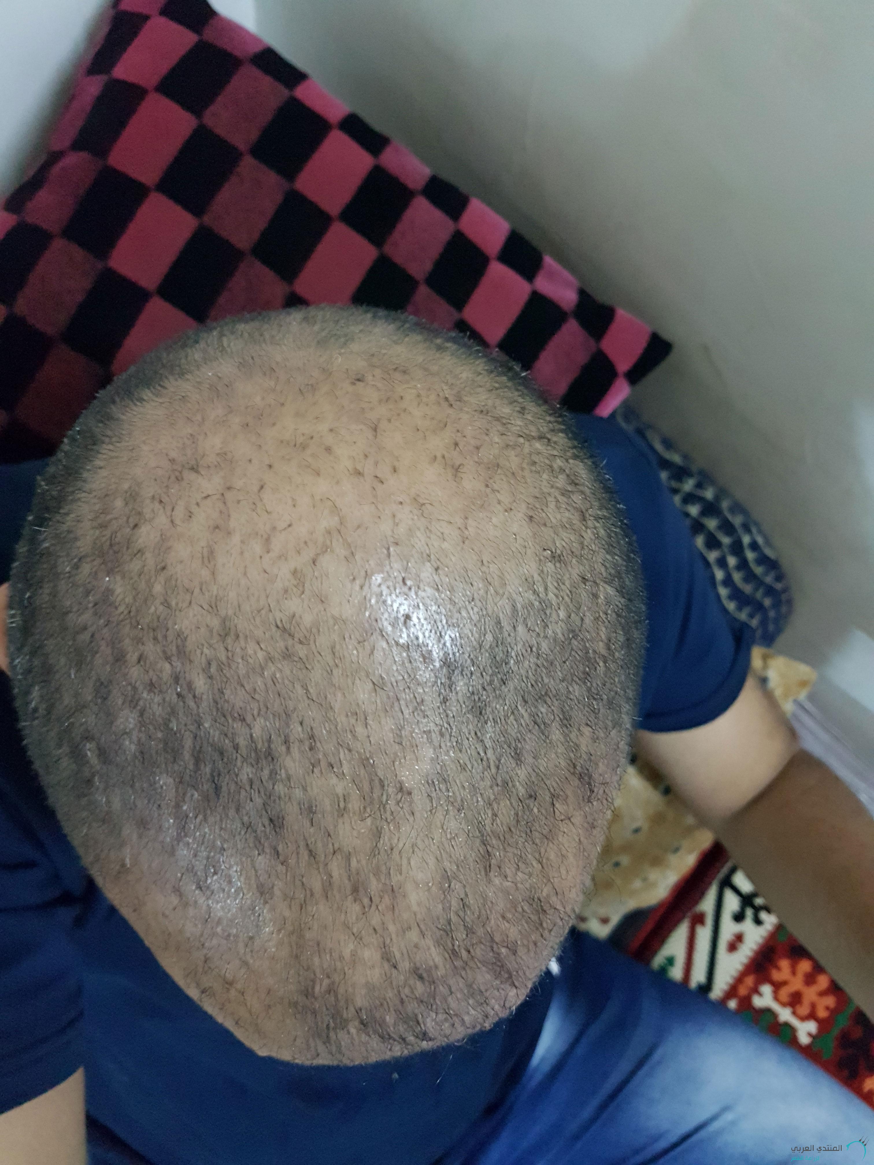 www.hairarab.com152660821737844.jpg