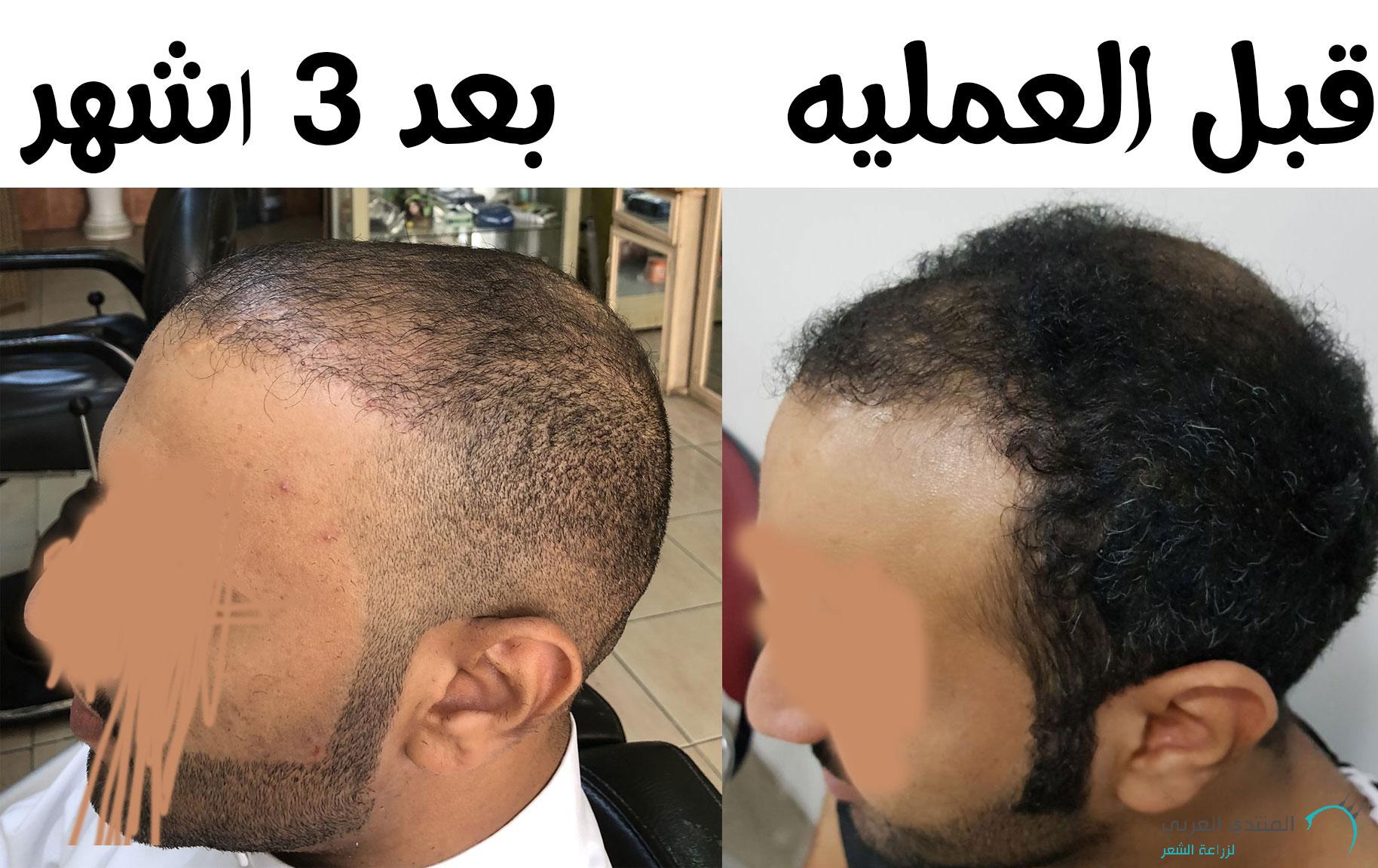 www.hairarab.com153022538530081.jpg