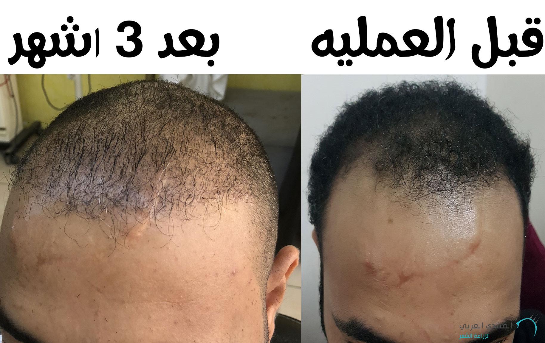 www.hairarab.com153022538543782.jpg