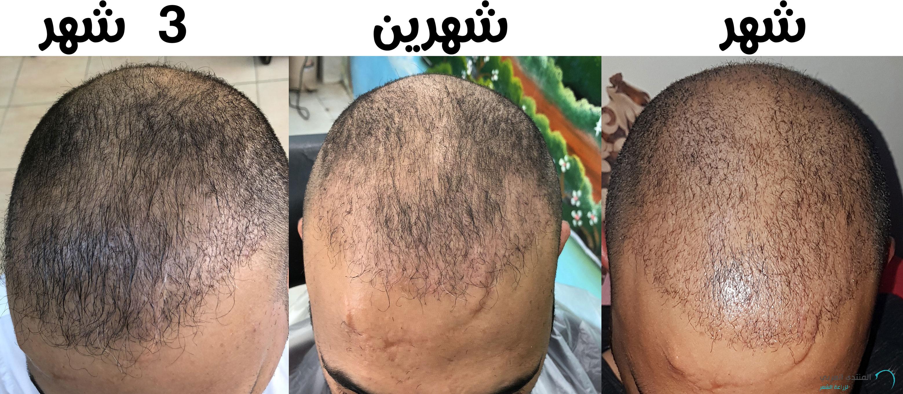 www.hairarab.com153022538553113.jpg