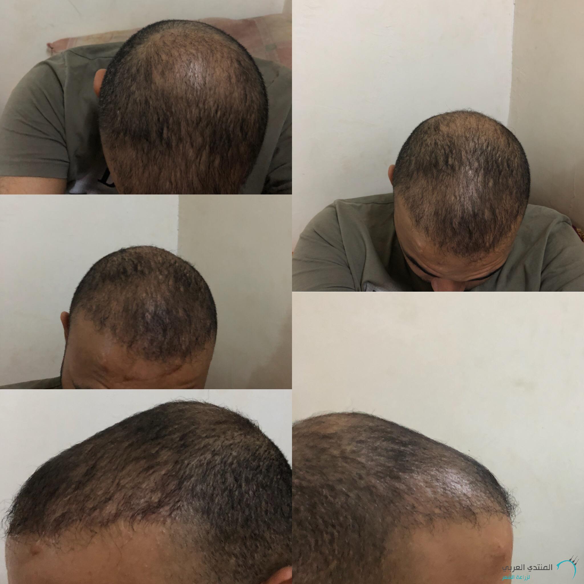 www.hairarab.com153151922548882.jpg