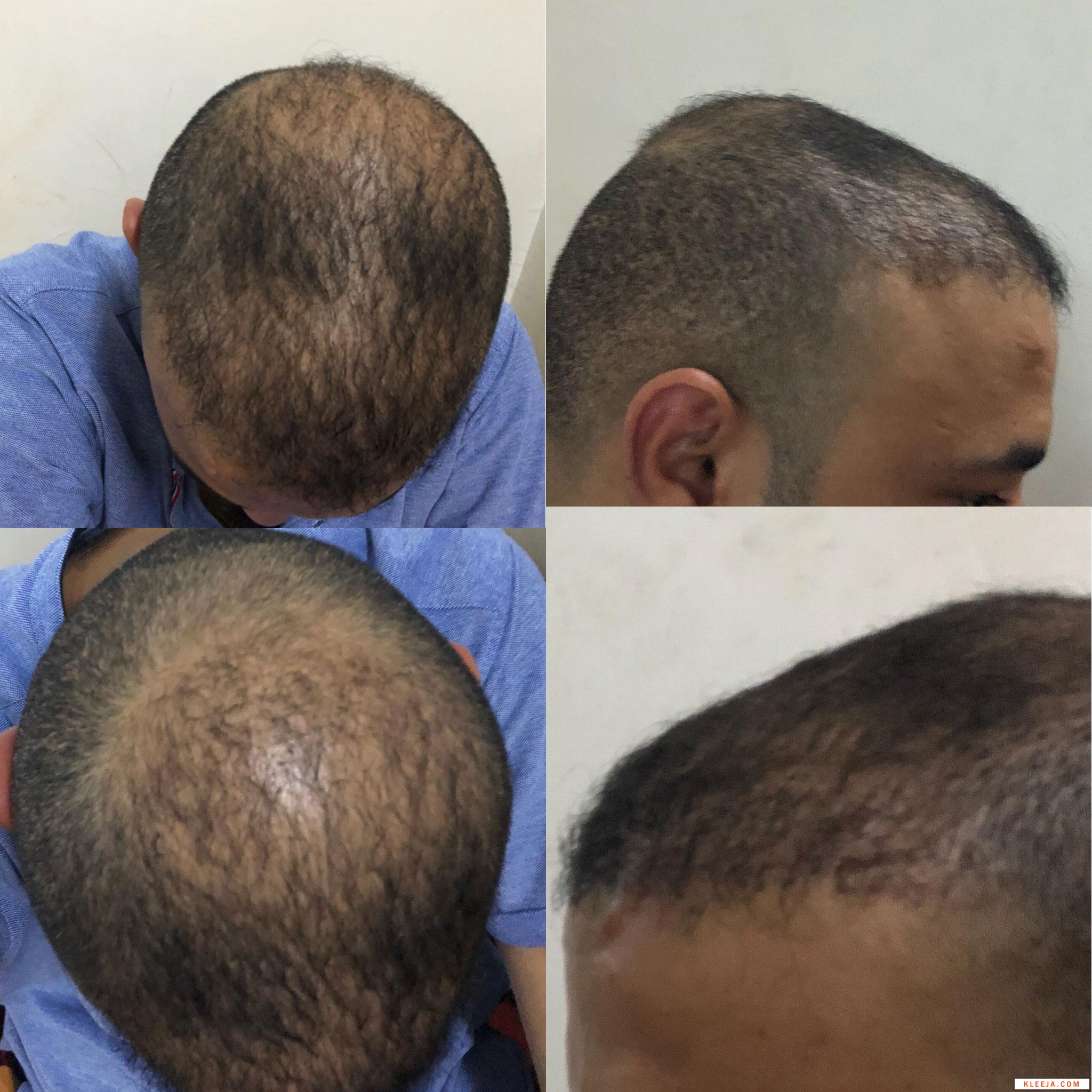 www.hairarab.com153273996825794.jpg