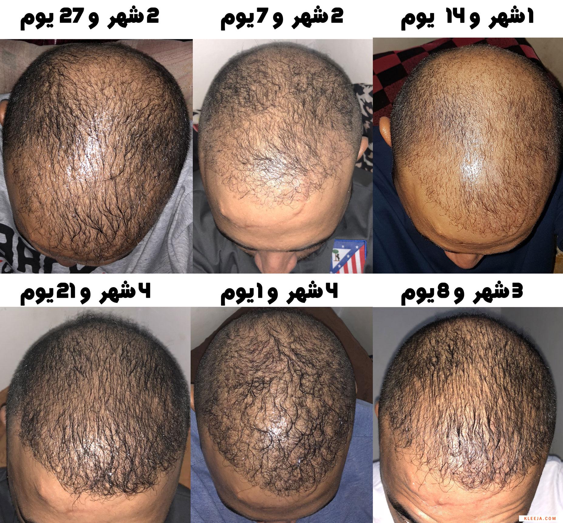 www.hairarab.com153473428935271.jpg