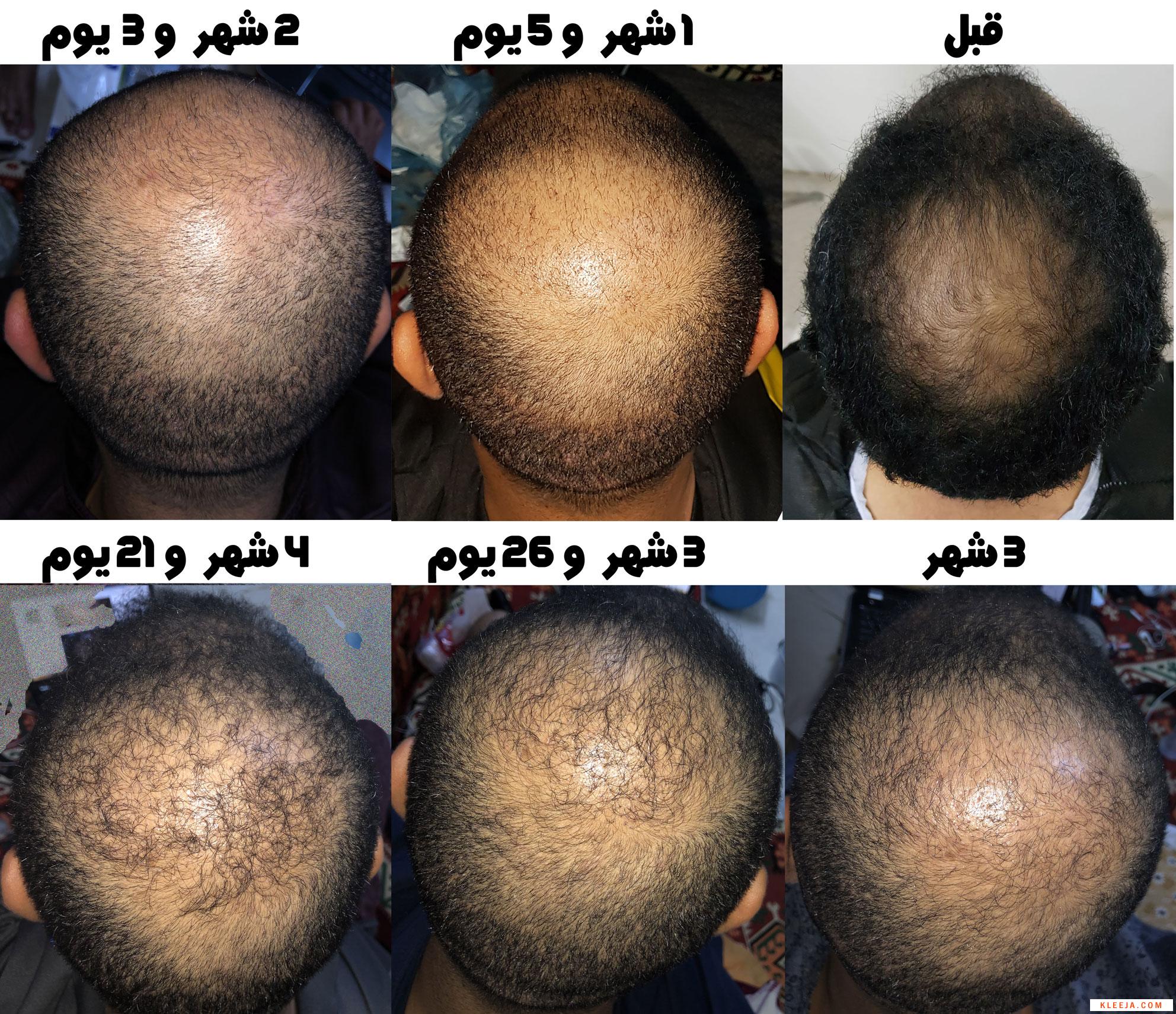 www.hairarab.com15347342895132.jpg