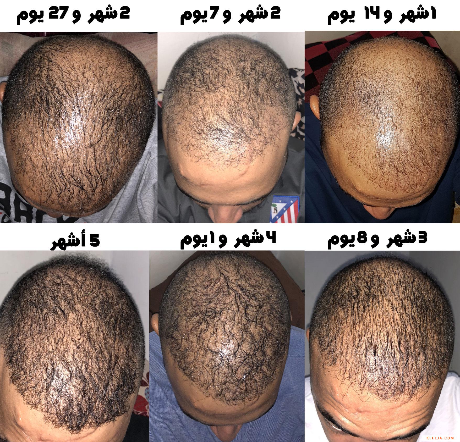 www.hairarab.com153548386669661.jpg