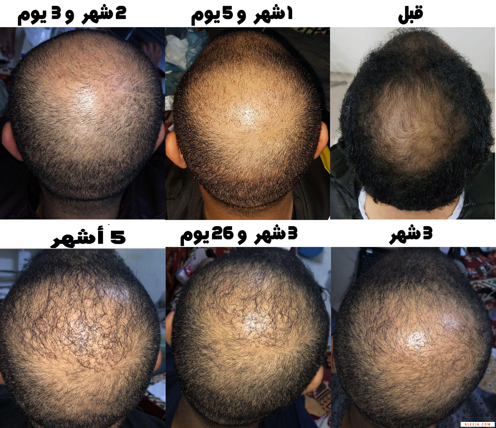 www.hairarab.com153548386685882.jpg