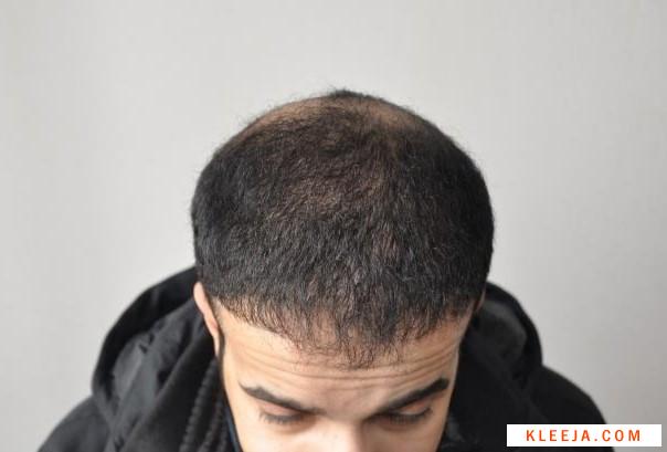 www.hairarab.com154564654705132.jpg