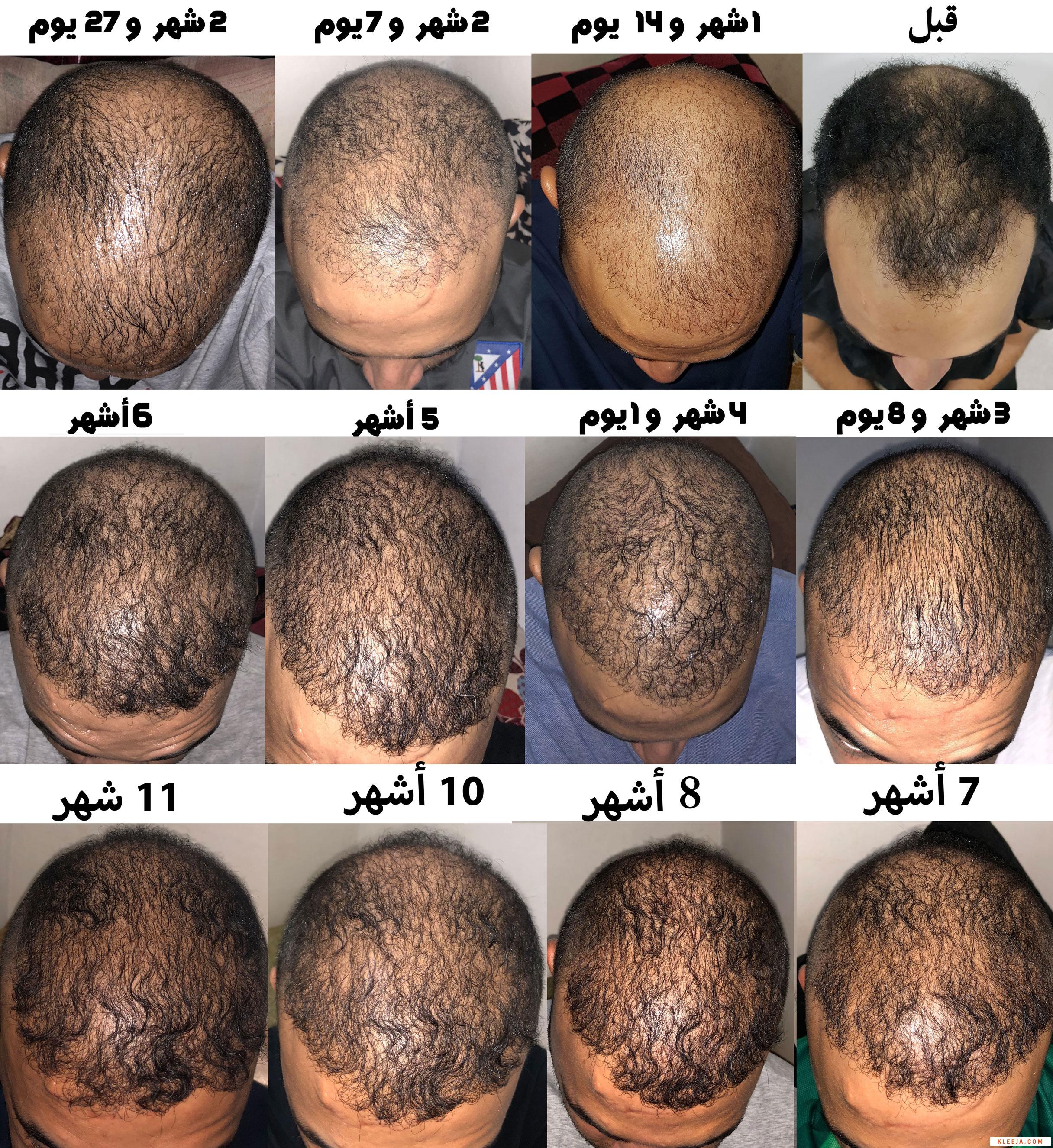 www.hairarab.com1551719397334910.jpg