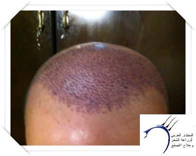 www.hairarab.com15f99f315e.jpg