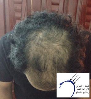 www.hairarab.com1c406cc54c.jpg