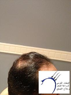 www.hairarab.com3a81e94cff.jpg