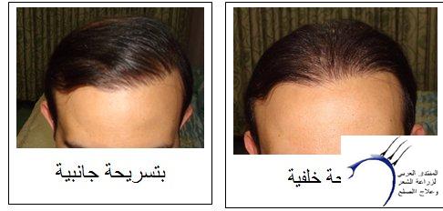 www.hairarab.com40e50932fc.jpg