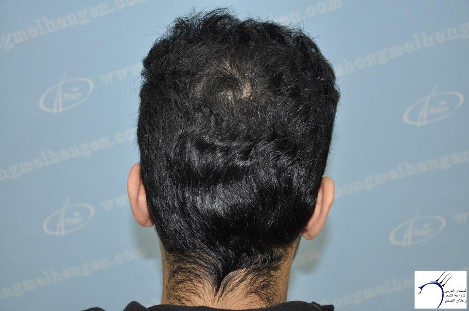 www.hairarab.com4c9b836c74.jpg