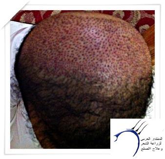 www.hairarab.com6073ec1d61.jpg
