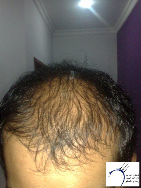 www.hairarab.com6fdcee21f1.jpg