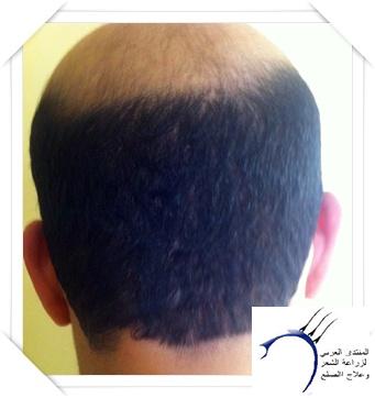 www.hairarab.com7c94d6aaaa.jpg