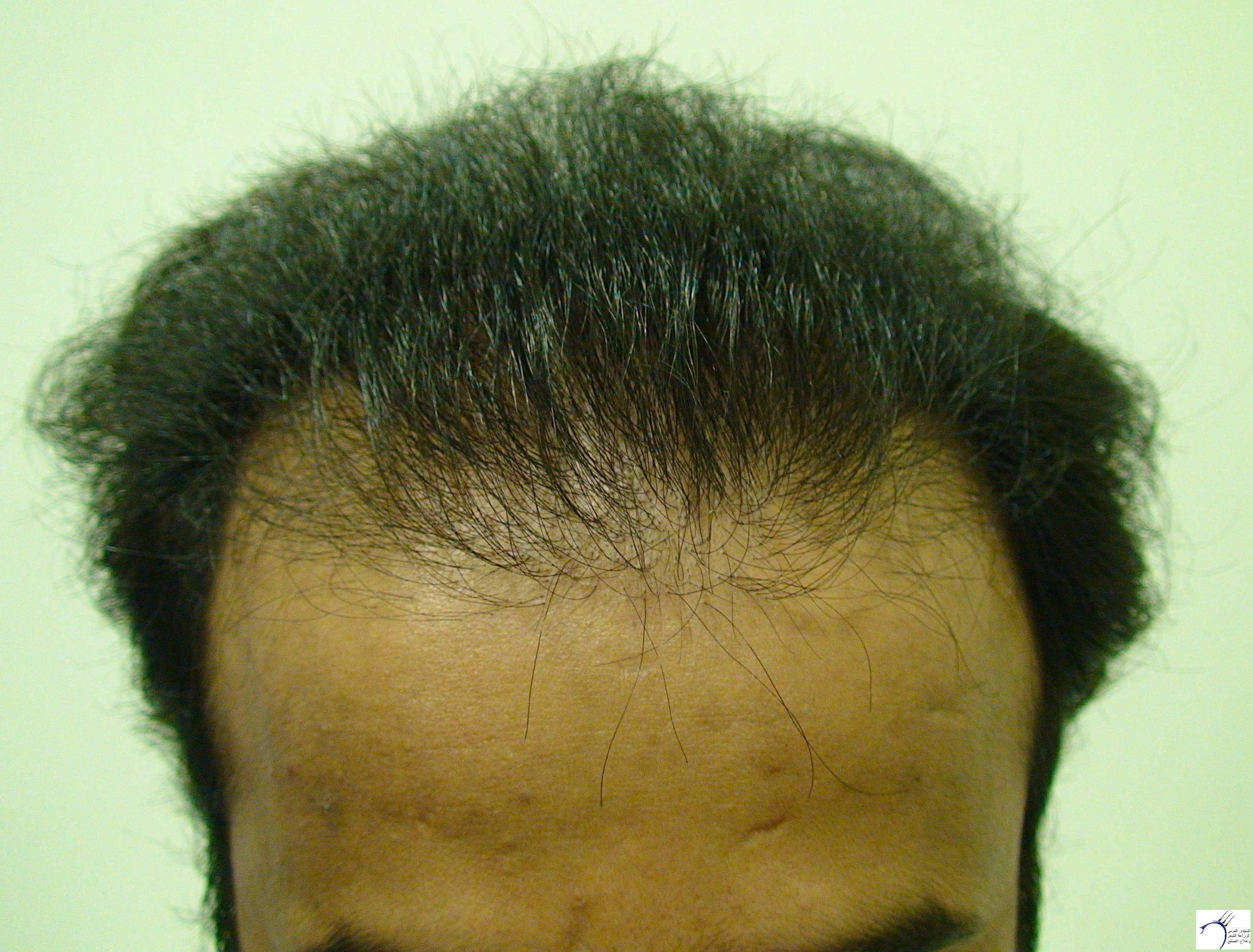 www.hairarab.com8efdcdea14.jpg