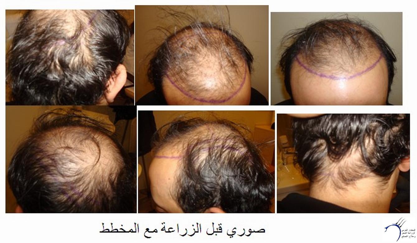 www.hairarab.com98e13860a3.jpg