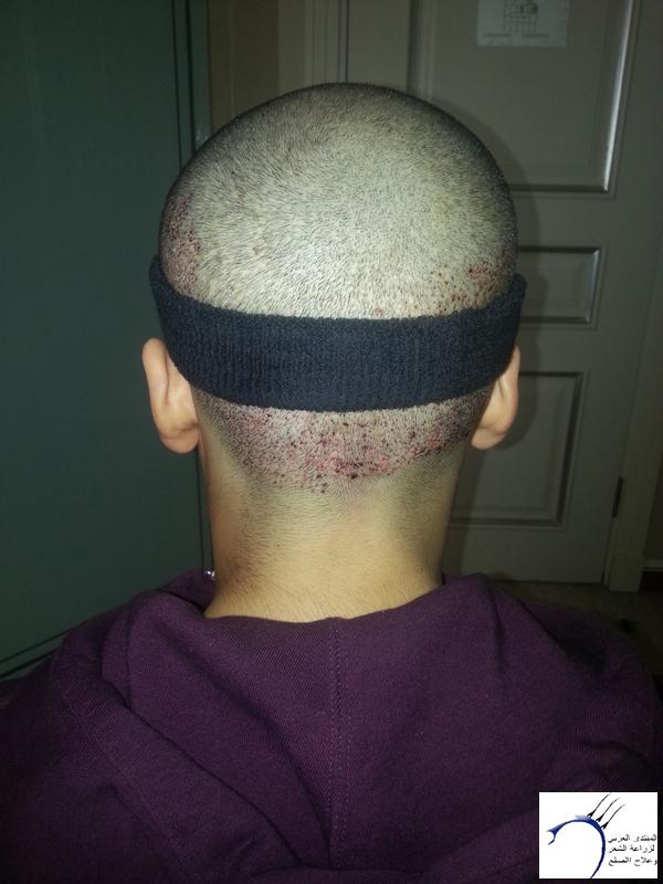 www.hairarab.com9c4fad98ff.jpg