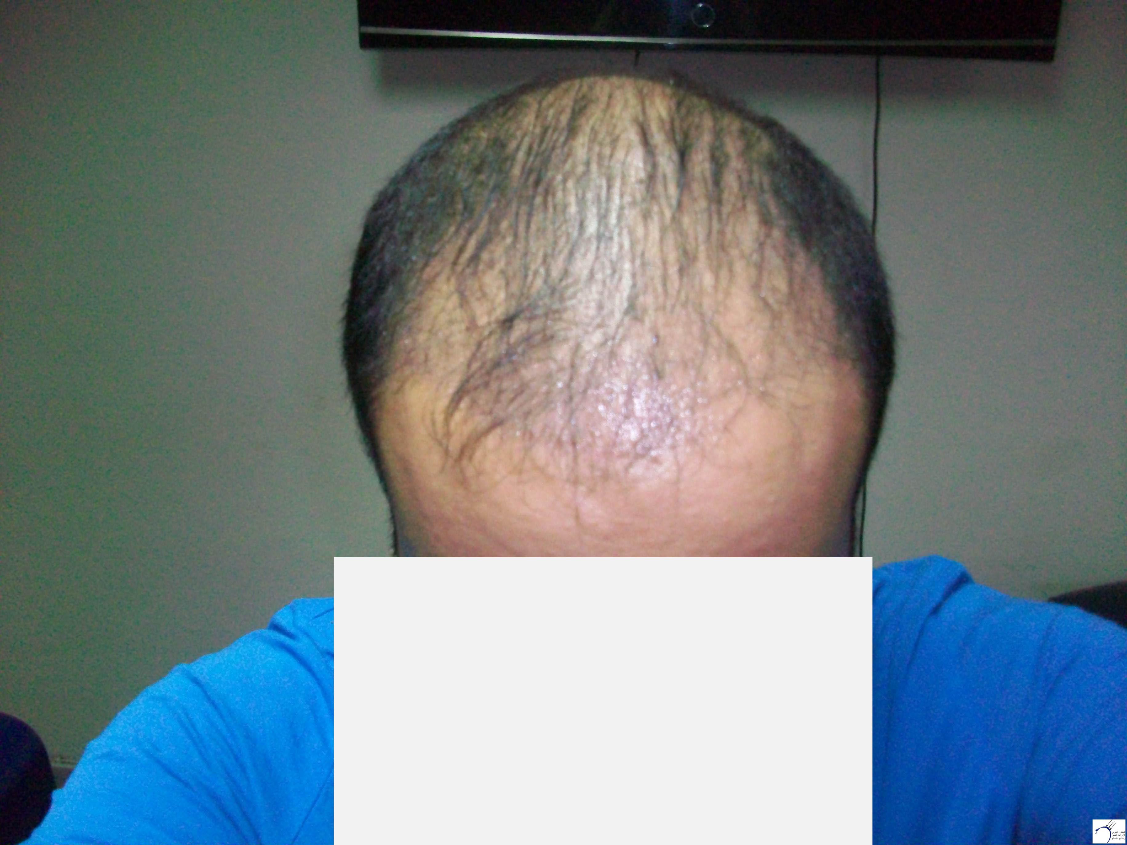 www.hairarab.comb5dd8faed2.jpg