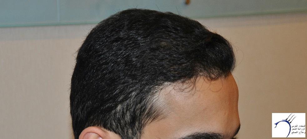 www.hairarab.comb91fe6e1ad.jpg